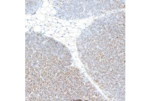 Immunohistochemistry (IHC) image for anti-CD4 (CD4) (AA 407-457) antibody (ABIN7453902) (Recombinant CD4 抗体  (AA 407-457))