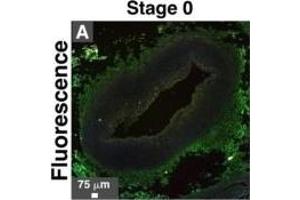 Immunohistological staining of artery tissues from diabetic subjects showing colocalization of serum proteins and mineral deposits. (Fetuin A 抗体  (AA 200-240) (AbBy Fluor® 594))