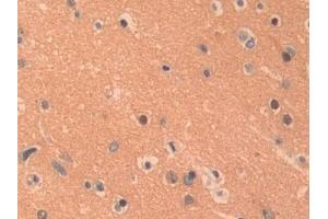 Detection of PKLR in Human Cerebrum Tissue using Polyclonal Antibody to Pyruvate kinase isozymes R/L (PKLR) (PKLR 抗体  (AA 219-420))