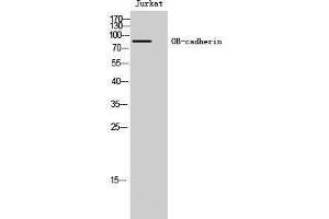 Western Blotting (WB) image for anti-Cadherin 11 (CDH11) (Internal Region) antibody (ABIN3176434) (OB Cadherin 抗体  (Internal Region))