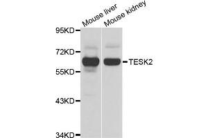 Western blot analysis of extracts of mouse liver and mouse kidney cell lines, using TESK2 antibody. (TESK2 抗体)