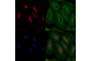 ABIN6261595 and ABIN6276640 staining  cells by IF/ICC. (ERG 抗体  (C-Term))