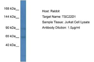 Host: Rabbit Target Name: TSC22D1 Sample Type: Jurkat Whole cell lysates Antibody Dilution: 1. (TSC22D1 抗体  (C-Term))