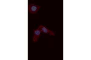 ABIN6276779 staining A549 cells by ICC/IF. (s100a4 抗体  (C-Term))