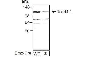 dilution: 1 : 1000, sample: mouse brain homogenate of WT and Nedd4-1f/f;Emx1-Cre± mouse (ECL staining) (NEDD4 抗体)