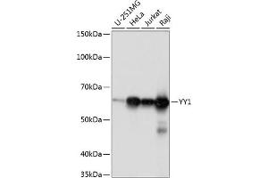 Western blot analysis of extracts of various cell lines, using YY1 antibody (ABIN7271428) at 1:1000 dilution. (YY1 抗体)