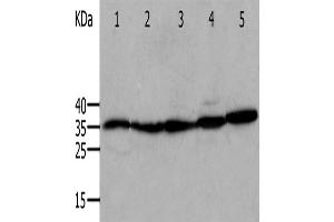 Western Blotting (WB) image for anti-Annexin A5 (ANXA5) antibody (ABIN2420983) (Annexin V 抗体)