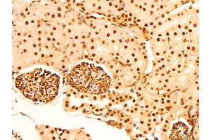 ABIN6267304 at 1/100 staining mouse kidney tissue sections by IHC-P. (C-JUN 抗体  (pSer243))