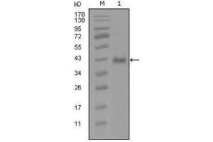 Western Blot showing AR antibody used against truncated Trx-AR recombinant protein (1). (Androgen Receptor 抗体  (AA 689-919))