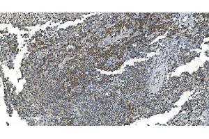 IHC analysis of TIMM8A/DDP using anti-TIMM8A/DDP antibody (ABIN7600039). (TIMM8A/DDP 抗体  (AA 14-97))