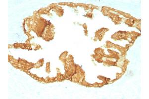 Formalin-fixed, paraffin-embedded Rat Oviduct with Cytokeratin, HMW Monoclonal Antibody (KRTH/1076). (Cytokeratin 2 抗体)