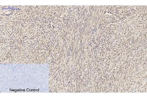 Immunohistochemical analysis of paraffin-embedded human uterus tissue. (SMAD2 抗体)