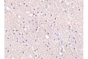Immunohistochemistry of CIDE-A in human brain tissue with CIDE-A antibody at 5 μg/ml. (CIDEA 抗体  (C-Term))