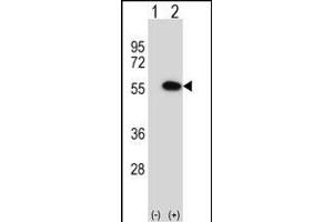 Western blot analysis of MINA (arrow) using rabbit polyclonal MINA Antibody (N-term) (ABIN656399 and ABIN2845694). (MINA 抗体  (N-Term))