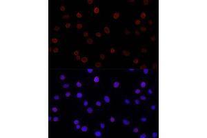 Immunofluorescence analysis of L929 cells using SUN2 antibody (ABIN7270136) at dilution of 1:200. (SUN2 抗体)