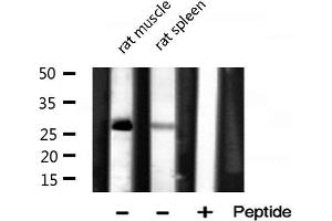 Western blot analysis of MRPL16 expression in various lysates (MRPL16 抗体  (Internal Region))