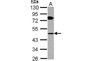 Western Blotting (WB) image for anti-AChE Q Subunit (COLQ) (AA 248-455) antibody (ABIN1497560) (COLQ 抗体  (AA 248-455))