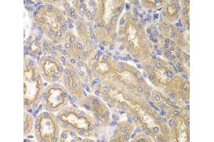 Immunohistochemistry of paraffin-embedded Rat kidney using IL12RB1 Polyclonal Antibody at dilution of 1:200 (40x lens). (IL12RB1 抗体)