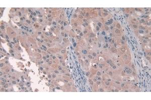 Immunohistochemistry (IHC) image for anti-serpin Peptidase Inhibitor, Clade A (Alpha-1 Antiproteinase, Antitrypsin), Member 5 (SERPINA5) (AA 43-406) antibody (ABIN7435505)