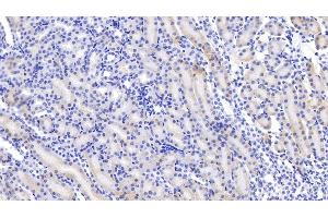 Detection of ABP1 in Mouse Kidney Tissue using Polyclonal Antibody to Amiloride Binding Protein 1 (ABP1) (DAO 抗体  (AA 292-460))