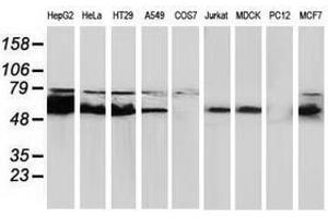 Image no. 4 for anti-Catalase (CAT) antibody (ABIN1497109)