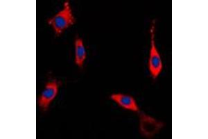 Immunofluorescent analysis of ROCK1 staining in NIH3T3 cells. (ROCK1 抗体  (Center))