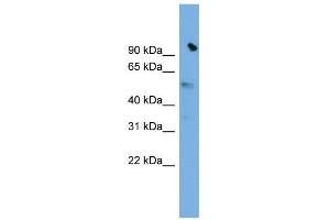 WB Suggested Anti-SLC25A25 Antibody Titration:  0. (SLC25A25 抗体  (N-Term))