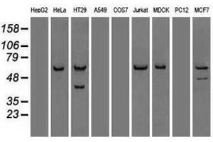 Image no. 8 for anti-Checkpoint Kinase 2 (CHEK2) antibody (ABIN1497497)