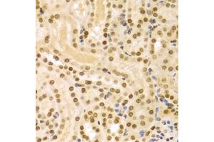 Immunohistochemistry of paraffin-embedded mouse kidney using DKC1 Antibody (ABIN5970956) at dilution of 1/100 (40x lens). (DKC1 抗体)