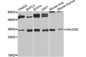 Western blot analysis of extracts of various cell lines, using HAVCR2 antibody. (TIM3 抗体)