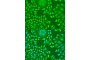 Immunofluorescence analysis of U2OS cells using CCND2 antibody (ABIN1875413) at dilution of 1:100. (Cyclin D2 抗体)