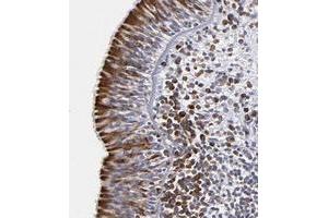 Immunohistochemical staining of human nasopharynx with CEP97 polyclonal antibody  shows strong cytoplasmic positivity in respiratory epithelial cells at 1:200-1:500 dilution. (CEP97 抗体)