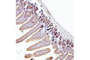 IHC analysis of EIF4A using anti-EIF4A antibody (ABIN7601309).