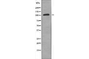 Western blot analysis of extracts from HUVEC cells, using ZNF387 antibody. (ST18 抗体  (Internal Region))