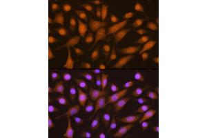Immunofluorescence analysis of L929 cells using SKP2 Rabbit pAb (ABIN6134430, ABIN6147822, ABIN6147824 and ABIN6223665) at dilution of 1:100. (SKP2 抗体  (AA 1-100))