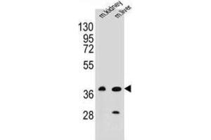 Western Blotting (WB) image for anti-CUGBP, Elav-Like Family Member 6 (CELF6) antibody (ABIN2996337)