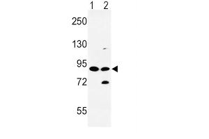 Western Blotting (WB) image for anti-Solute Carrier Family 8 (Sodium/calcium Exchanger), Member 1 (SLC8A1) antibody (ABIN3003974) (SLC8A1 抗体)