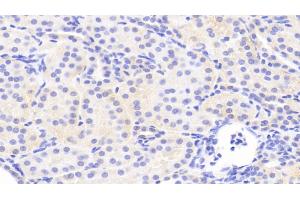 Detection of JNK1 in Human Kidney Tissue using Polyclonal Antibody to c-Jun N-terminal Kinase 1 (JNK1) (C-Jun N-Terminal Kinases (AA 145-419) 抗体)