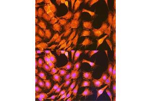 Immunofluorescence analysis of C6 cells using PHKG2 Rabbit pAb  at dilution of 1:100 (40x lens). (PHKG2 抗体  (AA 237-406))