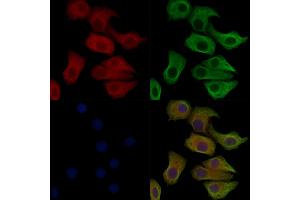 Phospho-IREB1 (Ser711) Antibody staining Hela cells(heat shock treatment) by IF/ICC.