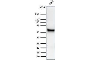 Western Blot Analysis of human Raji cell lysates using Spastin Mouse Monoclonal Antibody (Sp 6C6). (Spastin 抗体)