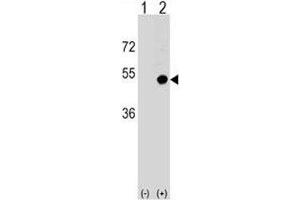 Western blot analysis of CD1d antibody and 293 cell lysate (2 ug/lane) either nontransfected (Lane 1) or transiently transfected (2) with the CD1D gene. (CD1d 抗体  (AA 177-206))