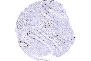 Appendix mucosa TOPO2A positive cells in the appendix mucosa reflect proliferating cells