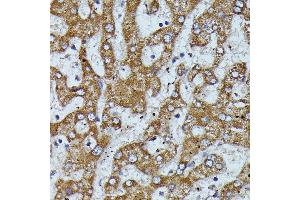 Immunohistochemistry (IHC) image for anti-Apolipoprotein C-III (APOC3) (AA 1-99) antibody (ABIN7265641)