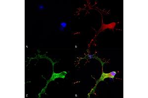 Immunocytochemistry/Immunofluorescence analysis using Mouse Anti-GABA-B Receptor 1 Monoclonal Antibody, Clone S93A-49 (ABIN1027717). (GABBR1 抗体  (AA 873-977))