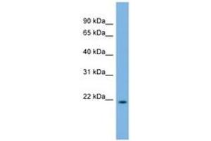 Image no. 1 for anti-DCMP Deaminase (DCTD) (C-Term) antibody (ABIN6743596) (DCMP Deaminase (DCTD) (C-Term) 抗体)