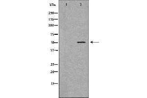 Western blot analysis of Jurkat  lysate using BCL2L13 antibody. (BCL2L13 抗体  (Internal Region))