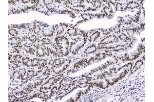 IHC analysis of nmt55/p54nrb using anti-nmt55/p54nrb antibody (ABIN3044530). (NONO 抗体  (N-Term))