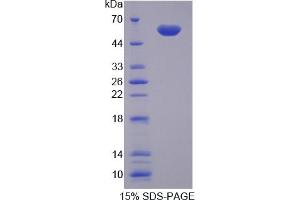 SDS-PAGE (SDS) image for Nicotinamide phosphoribosyltransferase (NAMPT) ELISA Kit (ABIN6574184)
