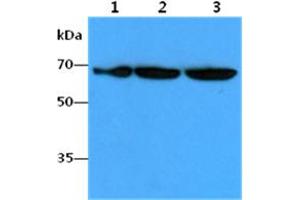 The Cell lysates (40ug) were resolved by SDS-PAGE, transferred to PVDF membrane and probed with anti-human FUBP1 antibody (1:1000). (FUBP1 抗体)